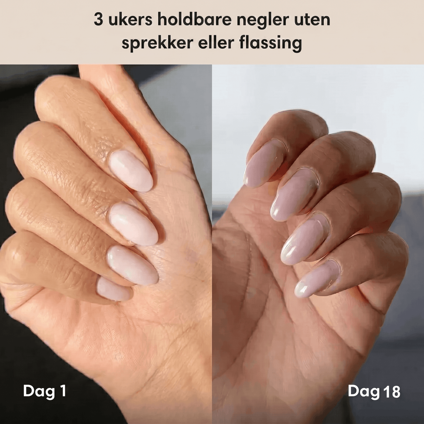 Polygel-neglesett | Porelie™