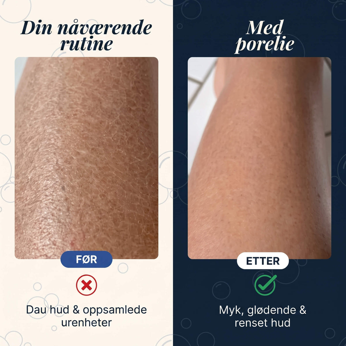 Porelie™ Eksfolierende Skrubbehåndkle